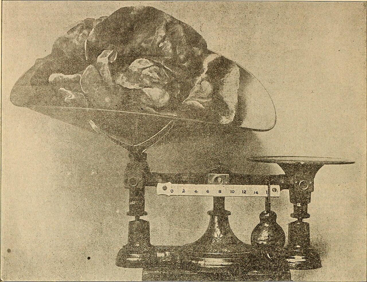 乒乓球战术解析:节奏与空间如何决定走势(青训人才视角)